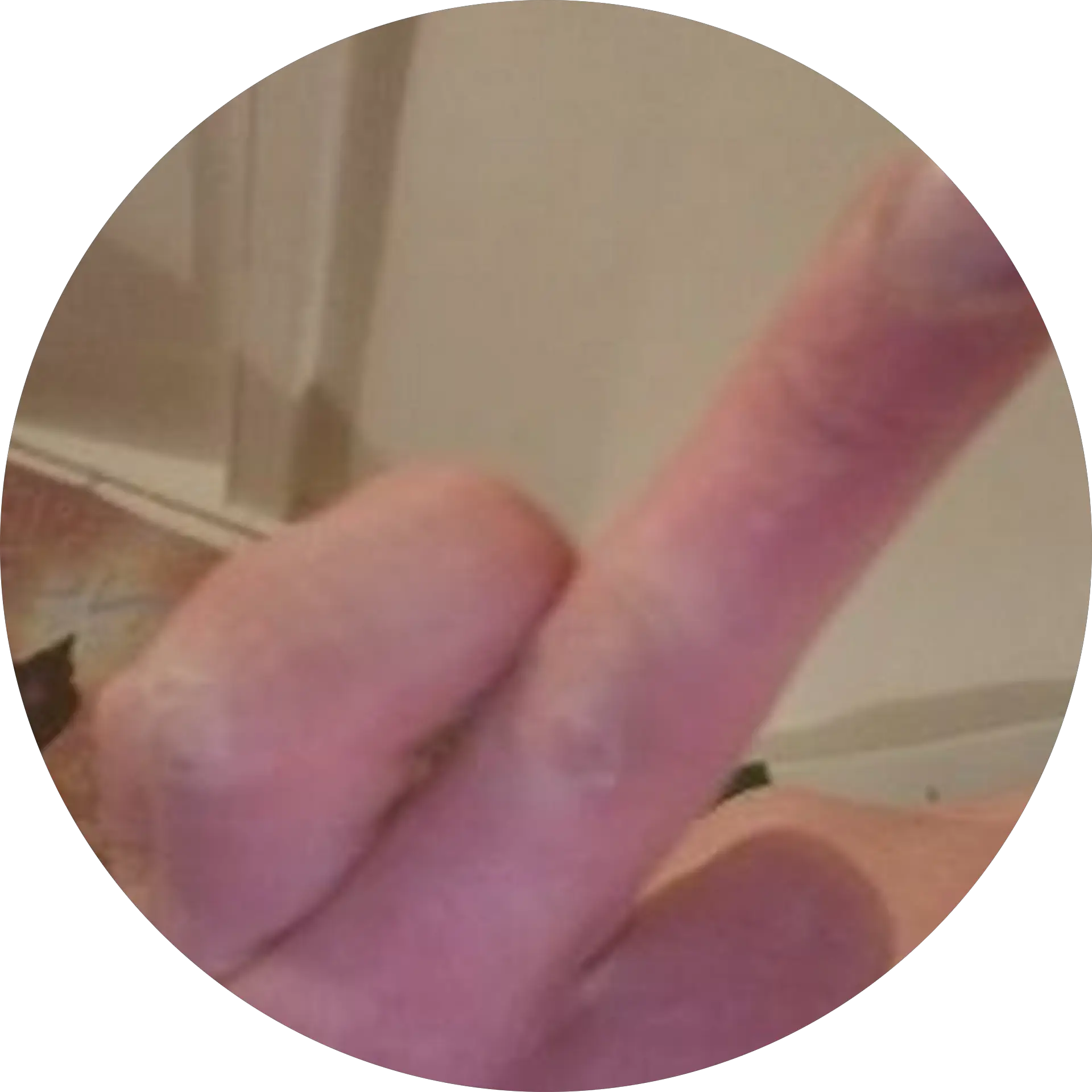 F